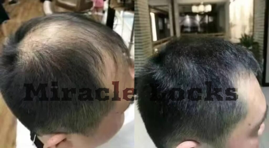 Miracle Locks Success Stories