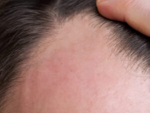 Miracle Locks Hair Oil